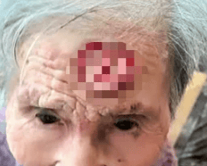 太狠了！98岁阿婆拿起剪刀，对准自已一刀下去…后果很严重！