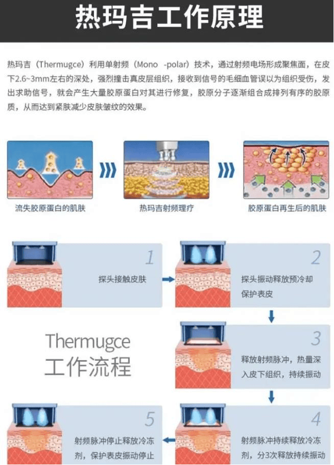 一文揭秘：热玛吉的功效作用及副作用？